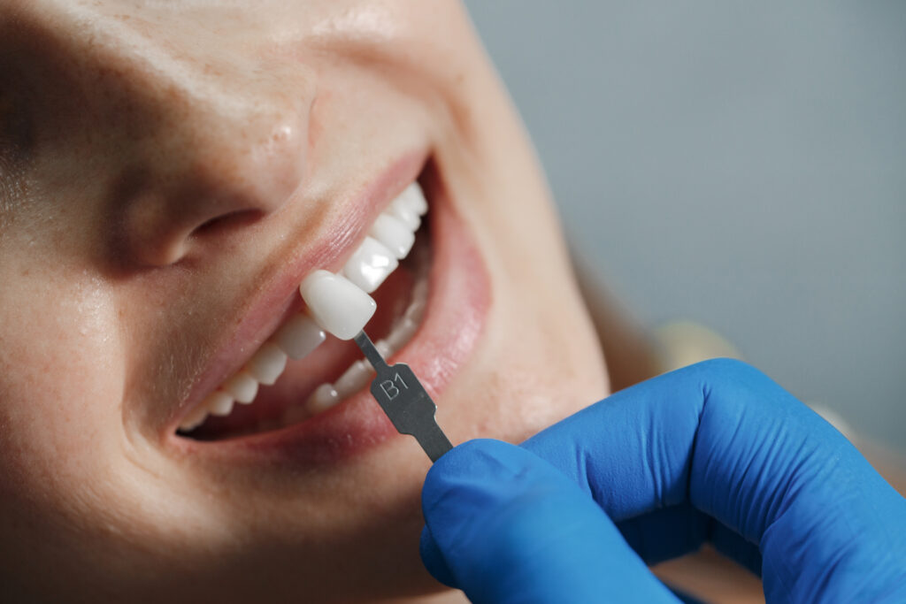 Dentysta prezentuje implant zęba na swojej pacjentce