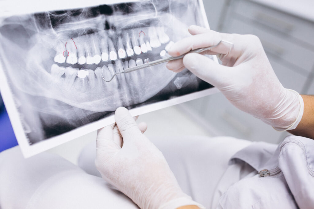 Lekarz trzymający zdjęcie RTG zębów